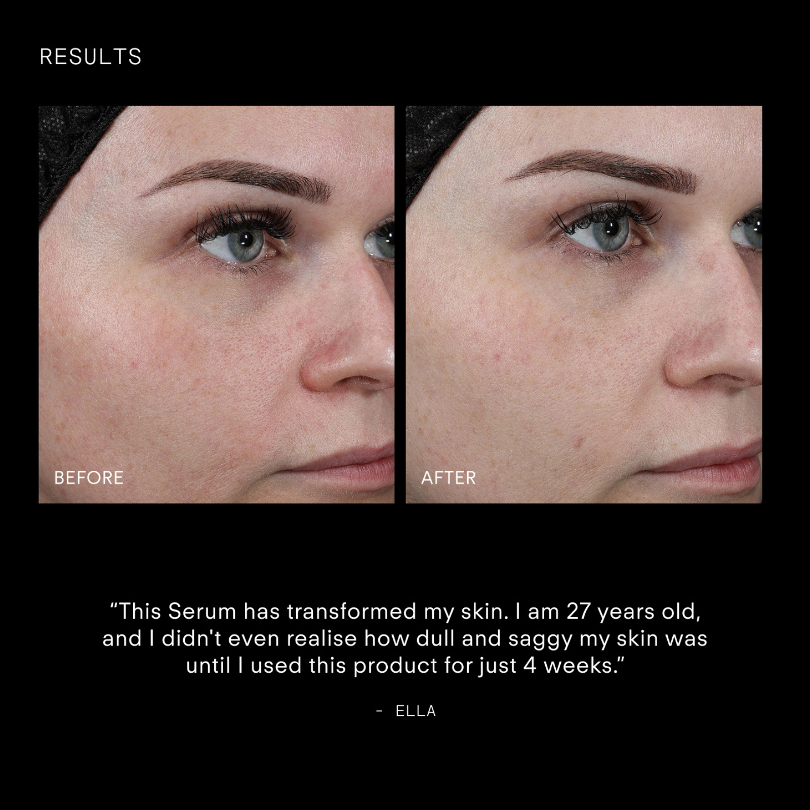 Youth Boost ExoSignal GF² Facial Serum